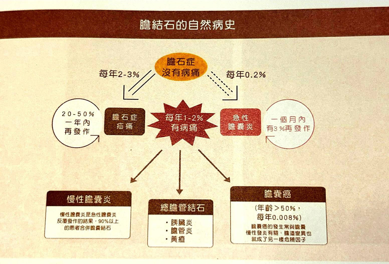 膽結石真會引發膽囊癌 全球罕見0.5%癌變機率發生在高雄男身上